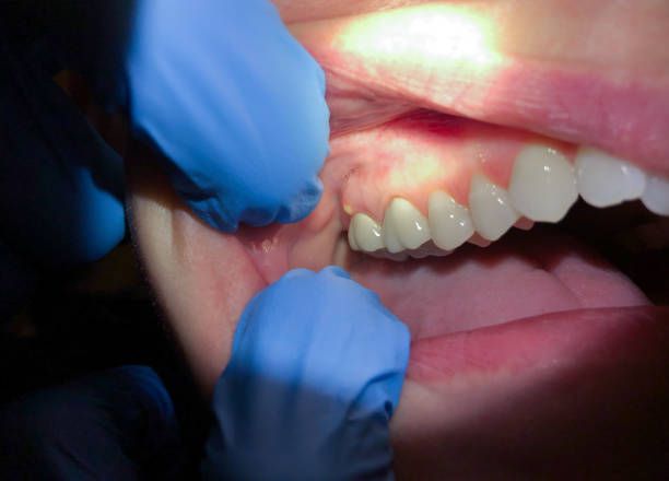 Professional Emergency Dental Service in IN